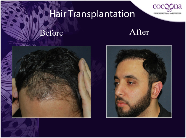 Cocoona Day Surgical Centre