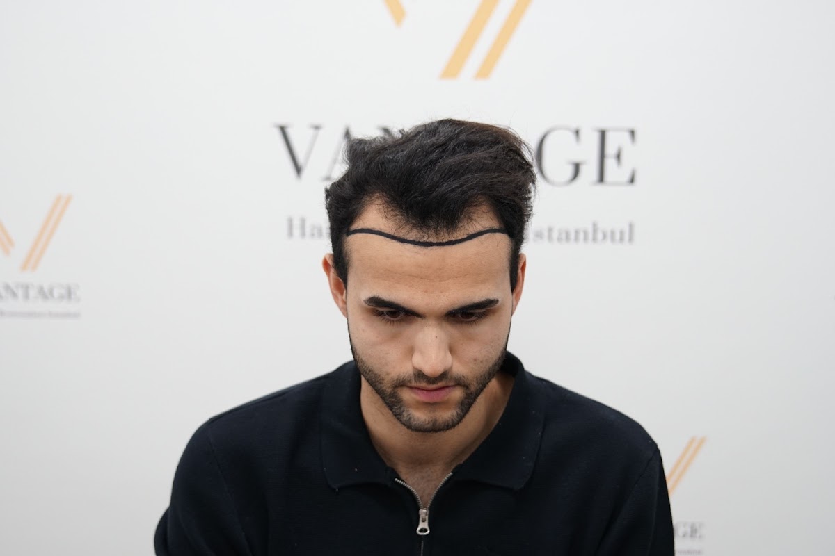 Vantage Clinic Antalya