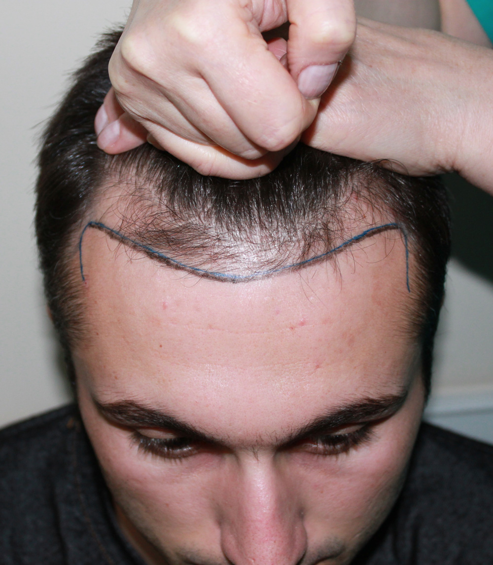 Dr. Popa Hair Transplant Clinic