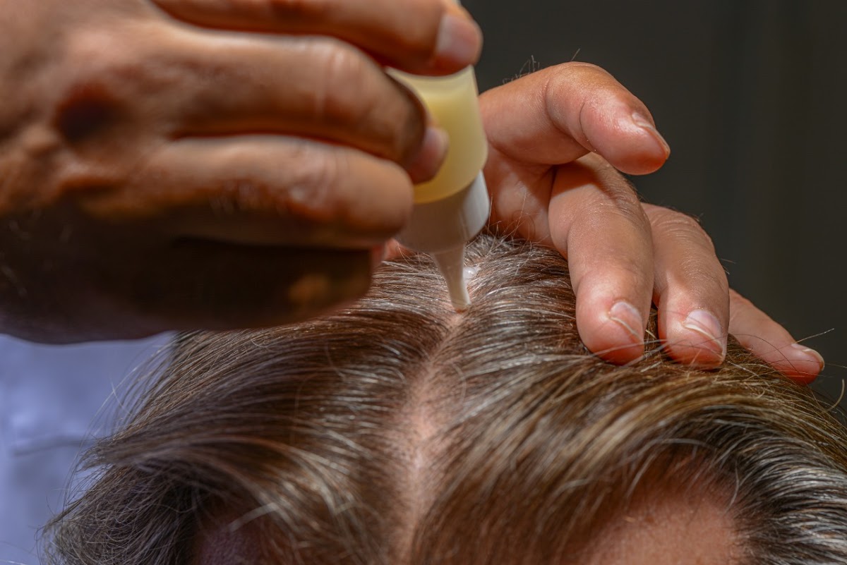 Centre International de Greffe de Cheveux Marrakech