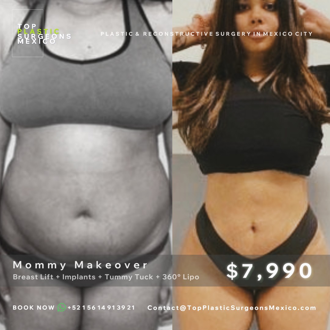 Top Plastic Surgeons Mexico (TPSM Surgery Center)