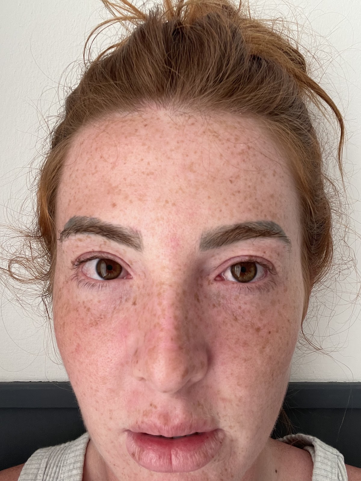 Dr. V Cosmetic Surgical Rejuvenation Center