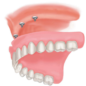 Americas Dental Care